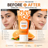 Orange Exfoliating gel (face/body gel)
