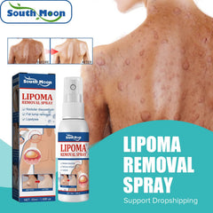 South Moon Lipoma Removal Cream