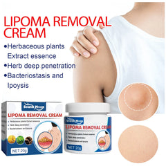 South Moon Lipoma Removal Cream