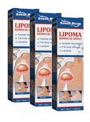 South Moon Lipoma Removal Cream